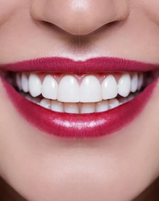 teeth01 teeth01