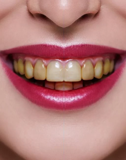 teeth02 teeth02